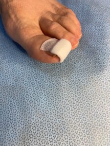nupor dressing big toe